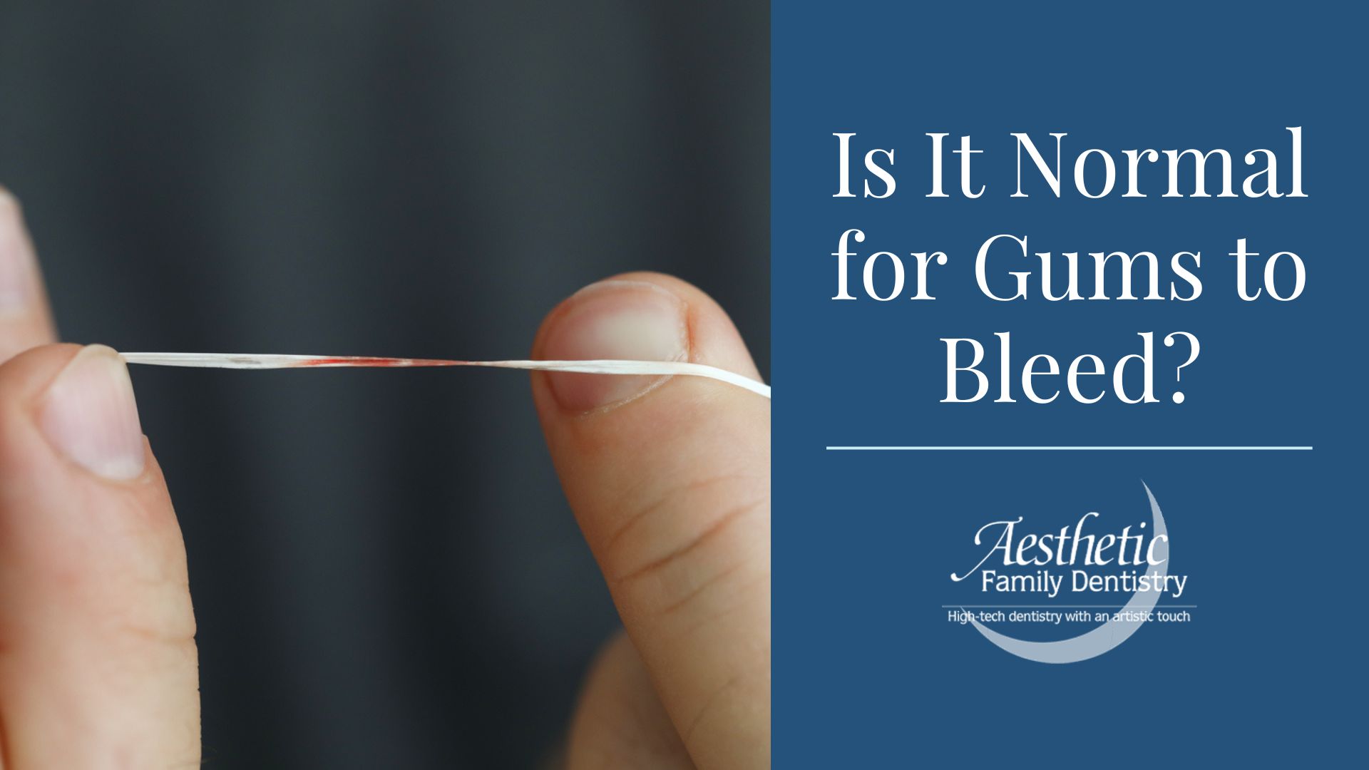 Is It Normal for Gums to Bleed? Aesthetic Family Dentistry